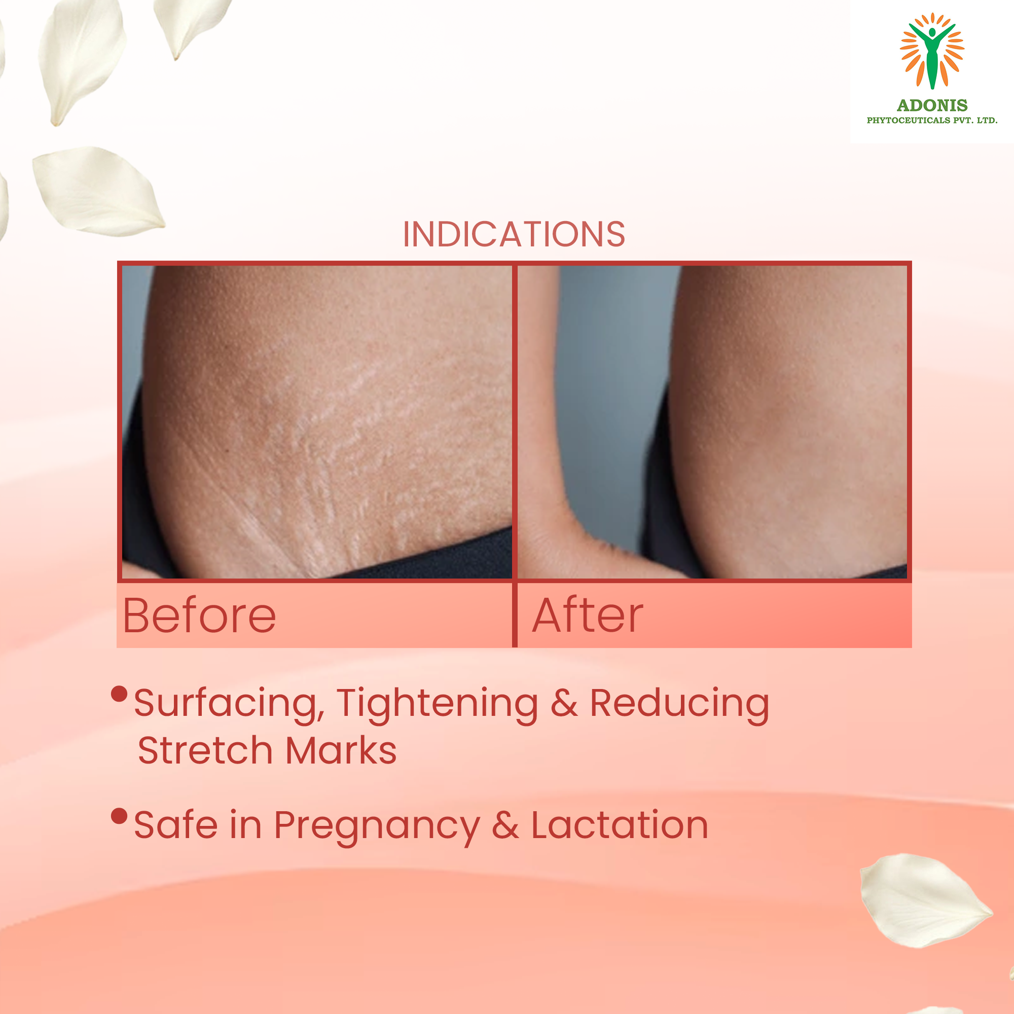 STRIE STRETCH MARKS CREAM