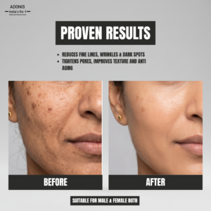 ADRITO Face Serum 50ml | Reduce Fine Lines Dark Sports & Wrinkles Serum | Evens Skin Tone & Brightens Dull Skin Lightweight & Fast Absorbing | For Men & Women Daily Use