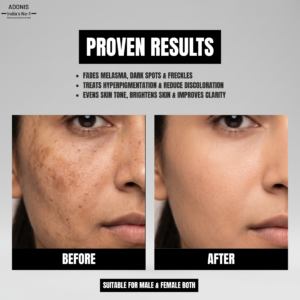 AD MELA TX Serum img7