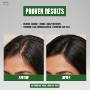 GRIP HAIR AD SHAMPOO img6