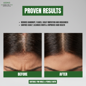 GRIP HAIR KT SHAMPOO _ img7
