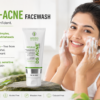 best anti acne face wash for oily skin in India | Adonis